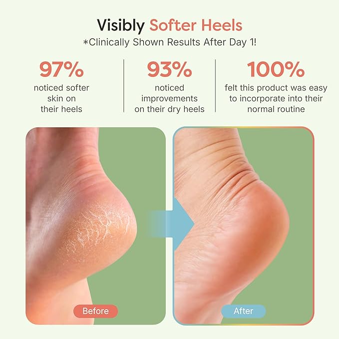 ZenToes Moisturizing Socks for Cracked Heel Treatment, Vitamin E, Olive Oil and Jojoba Oil Heel Socks, Stocking Stuffers for Women, Spa Self Care Gifts for Women (Holiday Stripes, Regular)