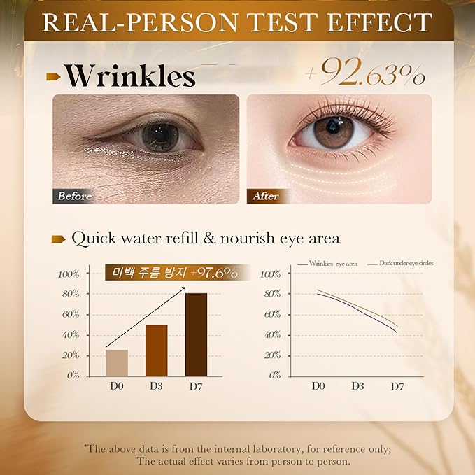 AKARY Roll on Eye Cream with 70% Rice Essence Extract, Moisturize, Tighten, Tender, Triple Roll & Glow Massage Head Under Roller Cream for Elasticity Wrinkles Puffiness Fine Lines-Korean Eye Cream