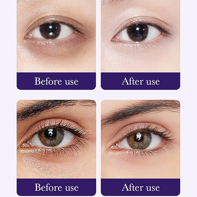 Aloe Vera Eye Masks - 60 PCS Under Eye Patches for Puffy Eyes and Dark Circles Treatments - Hydrating Eye Mask Skincare, Eye Gel Pads for Eye, Reduce Wrinkles and Fine Lines, Improve Eye Skin (Set C)