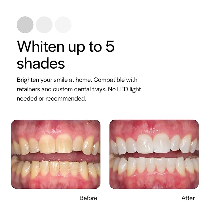 Opalescence 10% Teeth Whitening Kit - Gel Syringes Refills - Low Sensitivy (8 Units) - Fluoride, Carbamide Peroxide - Made in The USA by Ultradent 5211-4