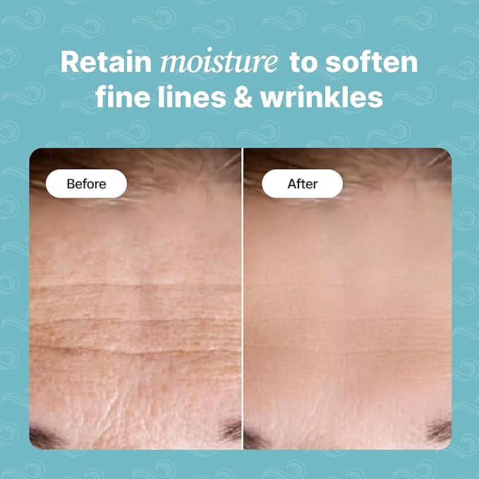 Bayside Forehead Wrinkle Patches – 20 Anti-Aging Forehead Pads with Resveratrol, Hyaluronic Acid, Snail Mucin, Collagen & Retinol for the Appearance of Forehead Lines