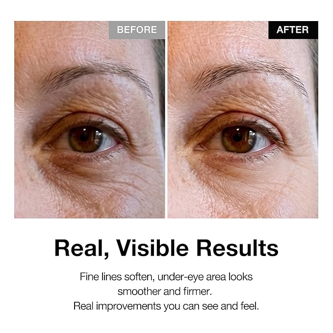 Retinol 0.1% Eye Cream with Bakuchiol 0.5% | Sensitive Skin Retinol for Wrinkles, Fine Lines & Dark Circles | Suitable for Face & Under-Eye Area | Korean Skincare | 30 ml (1.01 fl oz)