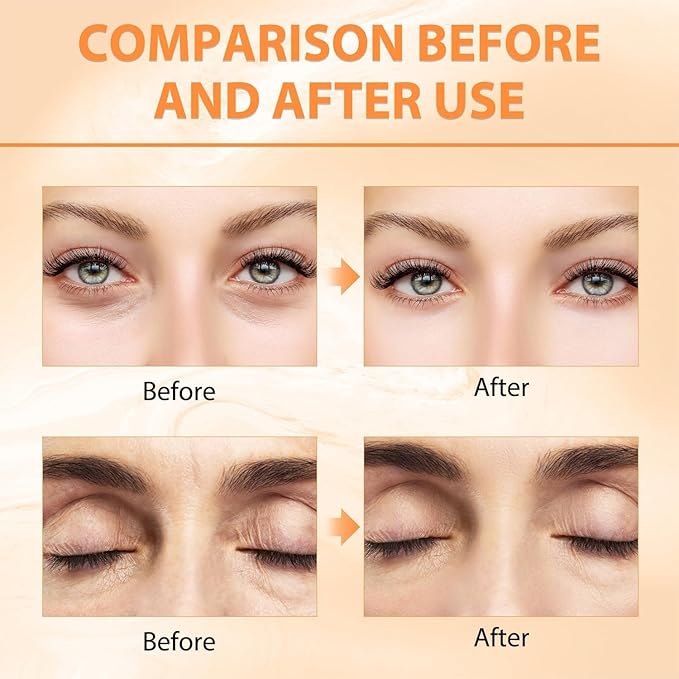 Revive + Glow Vitamin C Eye Balm,Hydrating Eye Cream,Improve Dark Circles,Refreshing and Non-Sticky (2 Pcs)