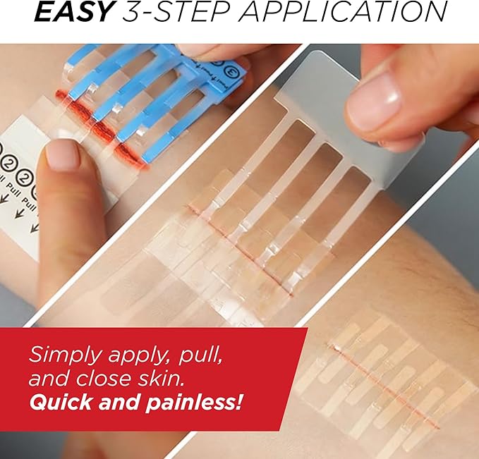 Clozex Emergency Laceration Closures - Repair Wounds Without Stitches, Skin Closure Device for 3 Individual Wounds Or Combine for Total Length of 4 1/4 Inches