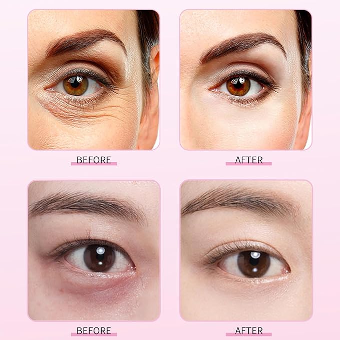Eyelift Serum - Mango Revitalize Eye Cream, Eyelift Serum Mango Revitalize Eye Care Cream, Removes 99% Of Eye Bags & Dark Circles Mango Revitalize Firming Eye Cream (3 Pcs)