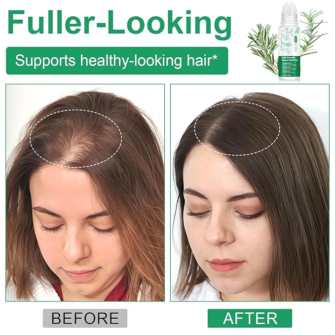 Hair Growth Serum Roll-On(20ml), Hair Growth Oil with 3% Rosemary, 3% Redensyl, 2% AnaGain Scientifically Proportioning, Helps Support Thicker, Fuller Hair Appearance, No-Rinse, Fast-Absorbing