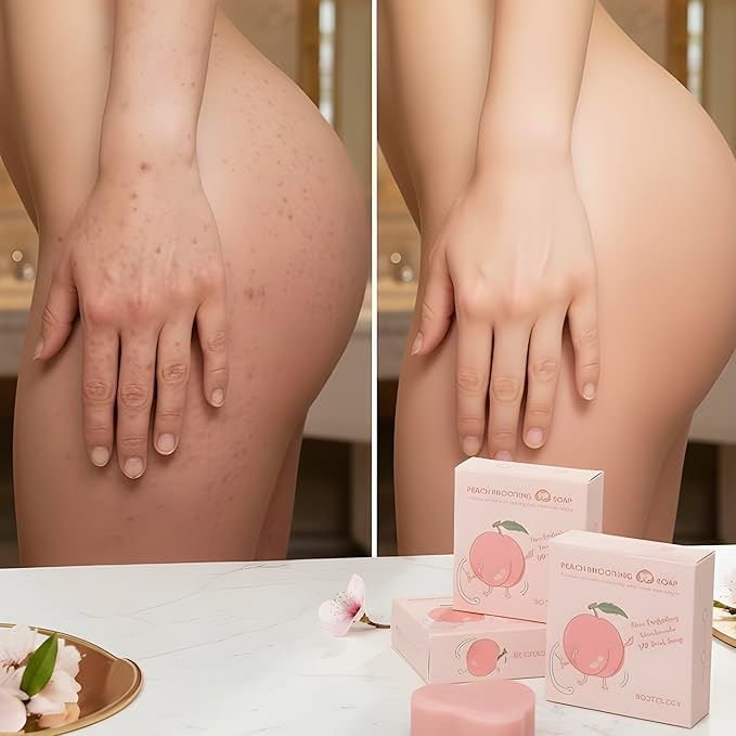 Korean Brightening & Firming Peach Soap, Tightens, Exfoliates, Smooths, and Perfects, with Fruit Acids, Natural Arbutin, & Walnut, Sensitive Skin Safe, Fades Spots, Cellulite and Stretch Marks, 3-Pack