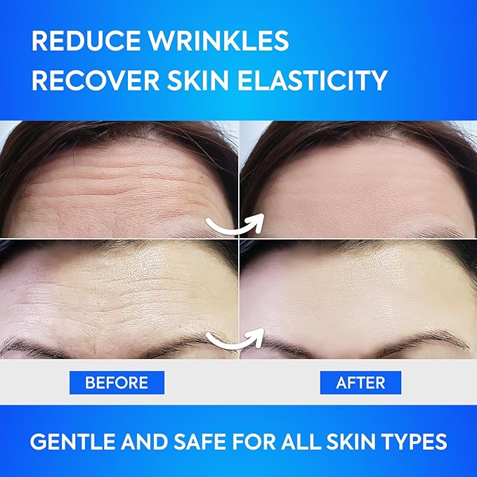 SILKDERMIS Forehead Wrinkle Patches 12Pcs with Aloe, Collagen, Vitamin E, Anti Wrinkle Patches, Forehead Wrinkles Treatment