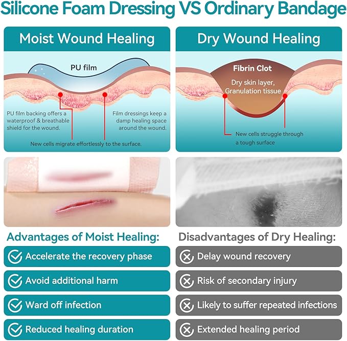 Dimora Ultra Soft Silicone Foam Dressing 4"x4" (10 Pack)- Super Absorbent Wound Dressing with Widened Border, Adhesive Foam Bandages for Bed Sores, Ulcer, Surgical Wound