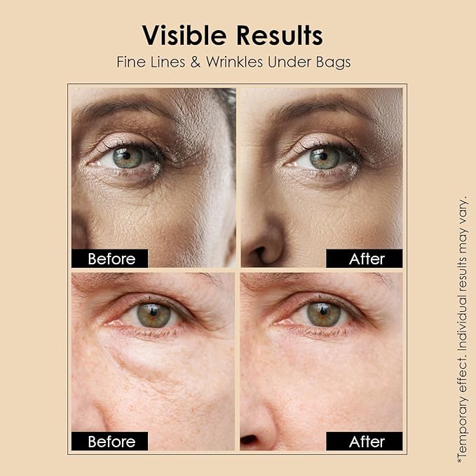 Instant Temporary Eye Tightener: Eye Tightener cream Reduces Under Eye Bags, Dark Circles & Puffiness, Anti Aging Fine Lines, Firm That Delicate Skin Under Your Eyes 0.85 OZ
