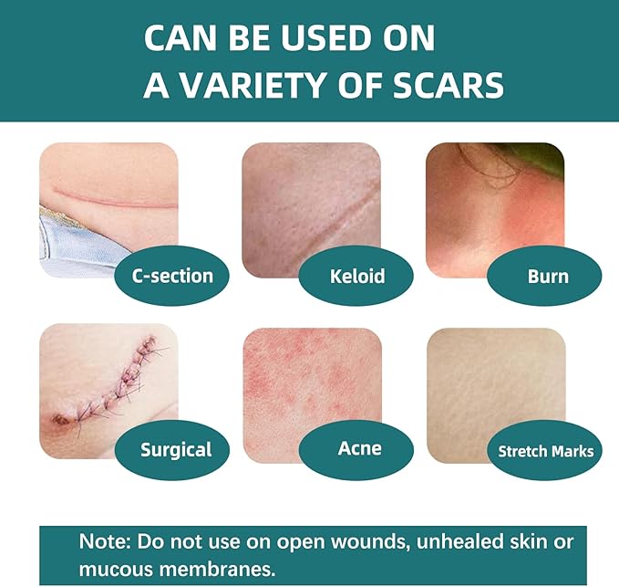 Silicone Scar Tape for Surgical Scars: Medical Grade Scar Gel Sheets for C-Section Tummy Tuck Recovery and Treatment – Reusable Scar Strips for Keloid Burn Acne Scars Removal (1.6'' x 60''Roll-1.5M)