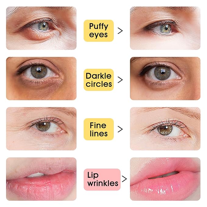 Adofect 40 PCS Under Eye Patches and Gold Lip Mask 24K Gold Eye Mask for Puffy Eyes Collagen Lip Masks and Crystal Eye Mask Reducing Fine Lines for Women and Men