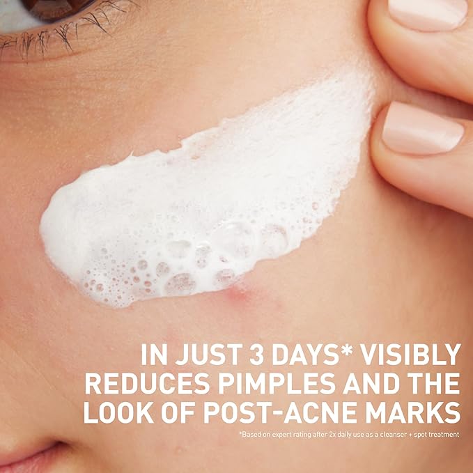 CeraVe Clay To Foam Acne Face Wash,Salicylic Acid & Kaolin Clay Acne Spot Treatment Clears Pimples & Blackheads, Prevents Breakouts, Hydrates & Soothes, Fragrance-Free, Non-Comedogenic,4oz,(Pack of 2)