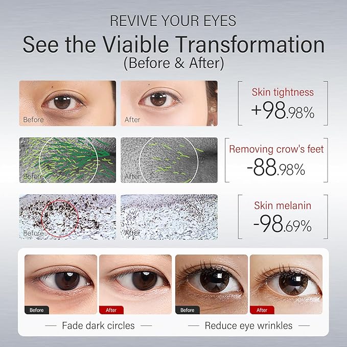 Korean 360 ° adhesive eye mask eye mask is suitable for reducing dark circles and puffiness. It is rich in hyaluronic acid, niacinamide, collagen, and anti wrinkle effects