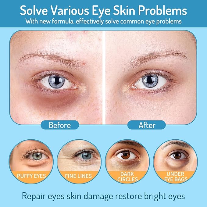 Revitalizing Under Eye Patches, 30 Pairs Brightening & Smoothing Eye Gels with Retinol, Collagen, Hyaluronic Acid, Hydrating Cooling Anti Aging Under Eye Masks for Dark Circles, Puffiness & Fine Lines