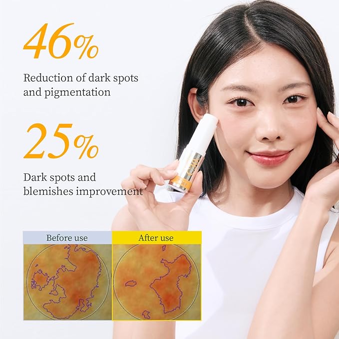 YADAH Vitamin C 30 Eye Correcting Balm (0.35oz) All-in-one Multi Care for Dark Spot Remover, 30% Pure Ascorbic Acid & Vitamin E for Radiant Nourished Skin Starter & Finishing Balm and Skin Brightening