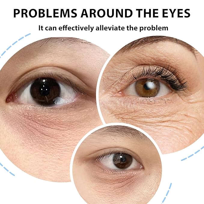 8PCS Hydrogel Eye Patch, 6g Moisturizing Milk Single Eye Mask Hydrogel Pads, Ideal for Women Dark Circles, Dryness Around Eyes, Reduce Skin Wrinkles, Puffy Eyes
