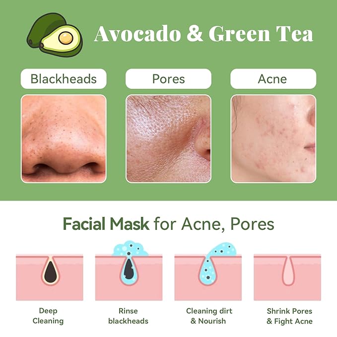 ANAI RUI Green Tea Face Mask with Avocado, Clay Facial Mask for Acne, Mud Mask for Face and Body, Face Cleansing Mask, Hydrating, Nourishing, Soothing, 120g/4.23 oz