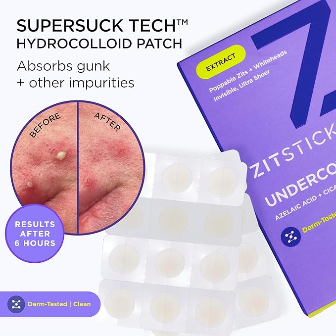 ZitSticka Undercover Invisible Pimple Patches for Face and Body - Ultra-Thin Hydrocolloid Acne Patches for Zits & Blemishes - Fast-Acting & Effective - 36 Count