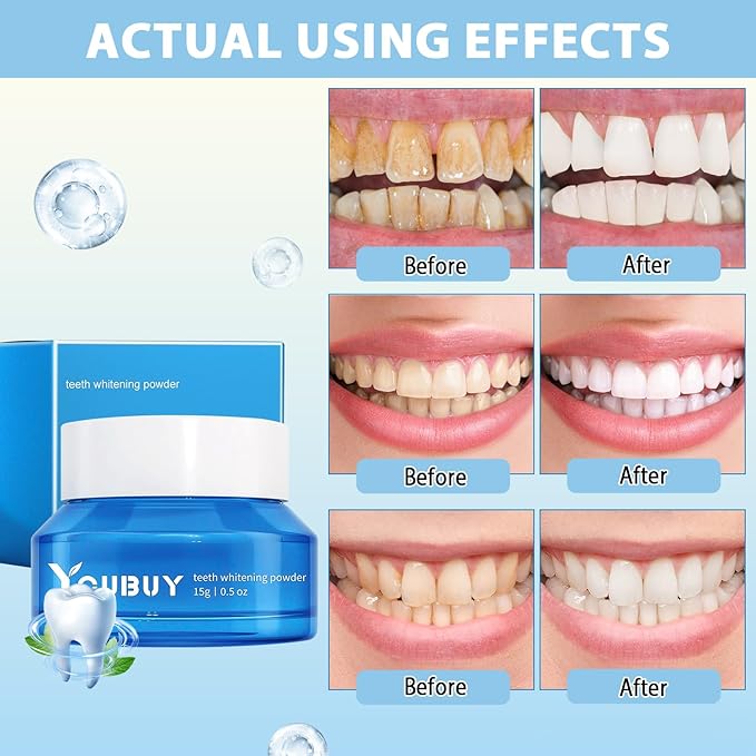 Teeth Whitening Powder, Natural Teeth Whitener, Teeth Whitening Powder Toothpaste,Whitening Tooth Powder,Instant Whitening Teeth,Stain Removal & Fresh Breath (2PCS)