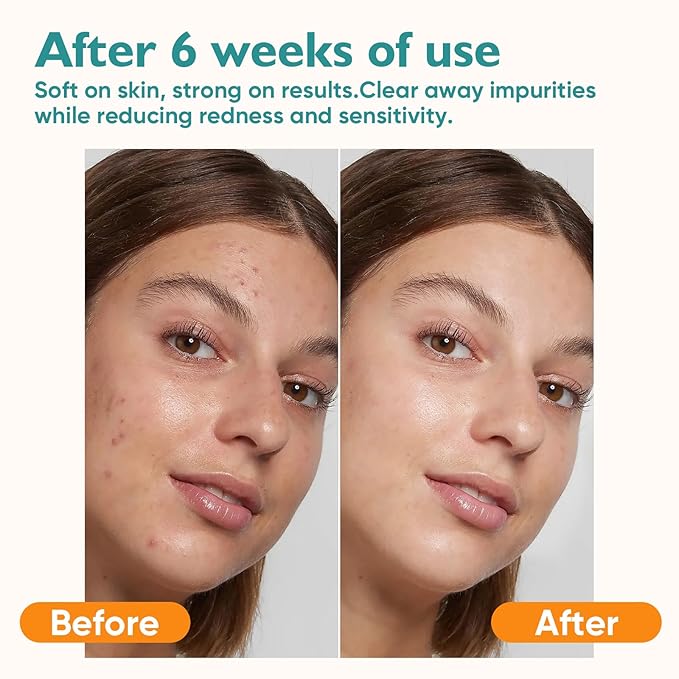 Face Towels, 200 Count Disposable Face Towelette for Washing Face, Skincare, Ultra Soft Facial Towel for Sensitive Skin, Lint-free Makeup Remover Dry Wipes - 4 Box