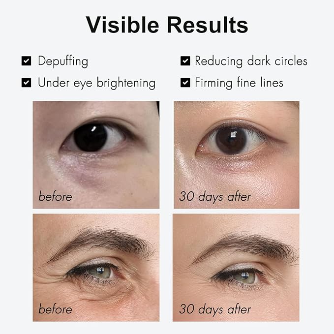 Loxadz Under Eye Brightener Serum with Cooling Rollerball, Zero Irritation Retinol Eye Cream for Puffy Bags, Fine Lines and Wrinkles, Hydrating Massage Roller for Dark Circles, 0.52 fl.oz