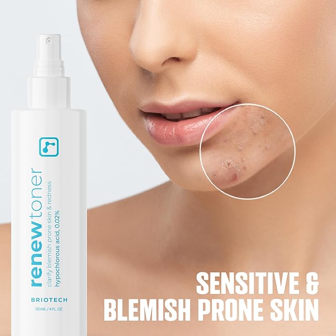 BRIOTECH Renew Toner, Hypochlorous Acid Spray, Minimize Appearance of Blemishes, Soothing Facial Mist for Sensitive Skin, Calm Redness & Bumps, Vegan, 4 fl oz (2 Pack)