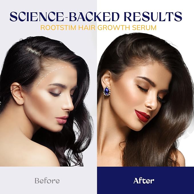 Hair Growth Serum, Rice Water & Biotin & Caffeine, Hair Growth Spray for Men & Women, Hair Oils for Hair Growth - Hair Thinning, Longer, Fuller Hair, Enriched with Seven Herbal Extracts