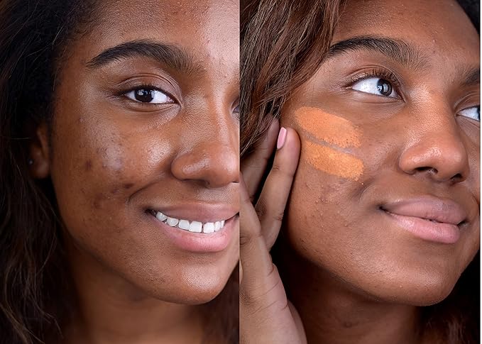 The Good Mineral Loves-You-Back 3in1 Mineral Powder Foundation (CARAMEL 4) | Designed for Acne-Prone, Sensitive Skin | Hyperpigmentation | Covers Dark Circles | 3IN1 - Concealer, Foundation + Powder