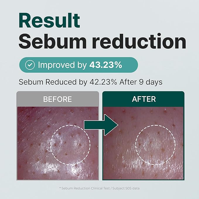 Lifderm Eye Cream with Collagen and Vibrating Device 20ml 9 Toner with Mugwort Extract 300ml Bundle