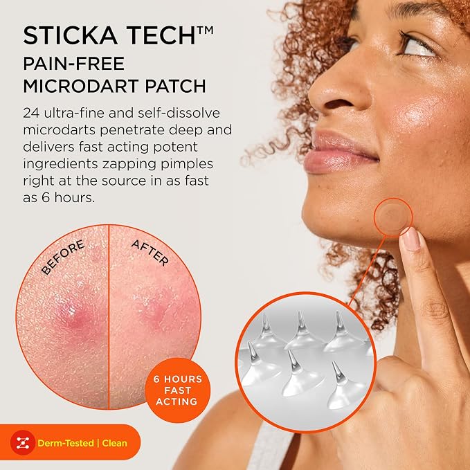 ZitSticka Killa Microdart Pimple Patches for Face - Most Potent Pimple Patch with Fast-Acting Microdarts - For Deep, Early-Stage Zits with Salicylic Acid - Regular 4 Count with Cleaning Swab