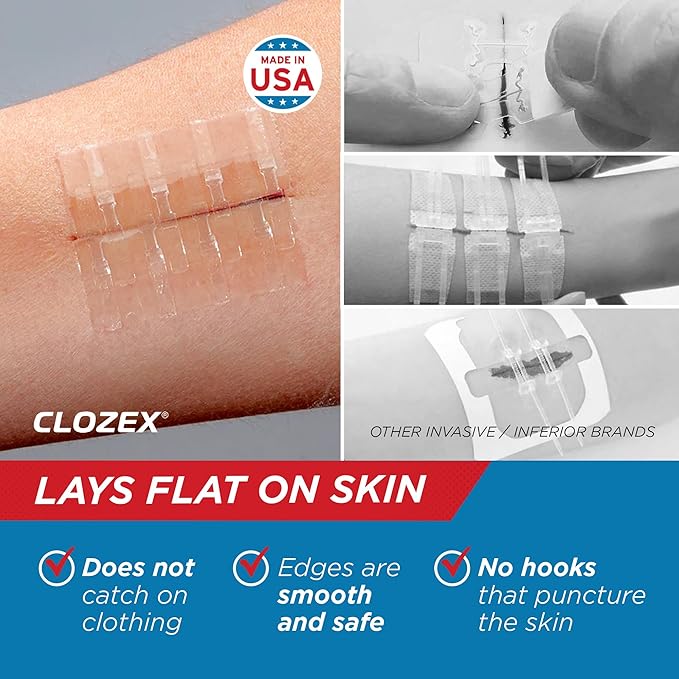Clozex Emergency Laceration Closures - Repair Wounds Without Stitches, Skin Closure Device for 3 Individual Wounds Or Combine for Total Length of 4 1/4 Inches