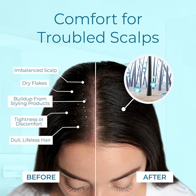 Tree To Tub Dry Scalp Spray - Intensive Scalp Moisturizer for Men & Women - Tea Tree Leave in Scalp Moisturizer for Dry Scalp, Full Spectrum Scalp Spray for Flaky Buildup & Excess Oil, Scalp Care