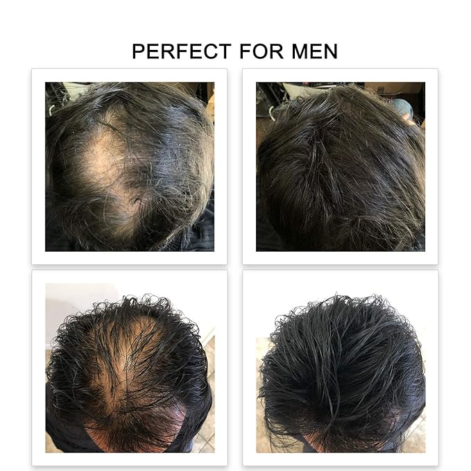 FEBRON Hair Fibers For Thinning Hair LIGHT BROWN Giant 30G For Women & Men Hair Loss Concealer Hair Powder Volumizing Based 100% Undetectable & Natural - Bald Spots Filler