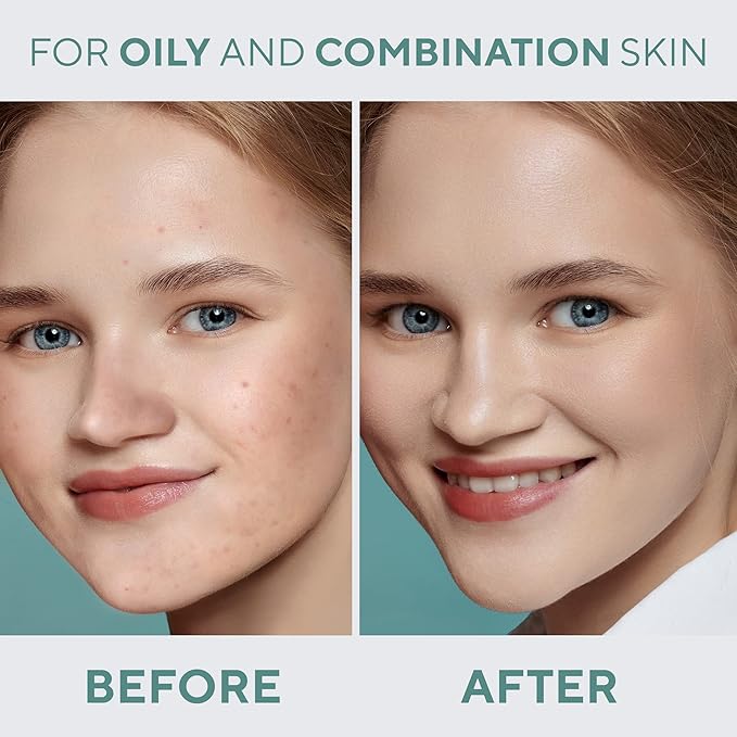 LAMEL Oh My Clear Face Full Coverage Foundation for Oily Skin, Salicylic Acid & Tea Tree Extract, Anti-Blemish Sensitive Skin Care, Organic & Oil-Free, 402 Deep Beige, 40 ml / 1.35 fl.oz