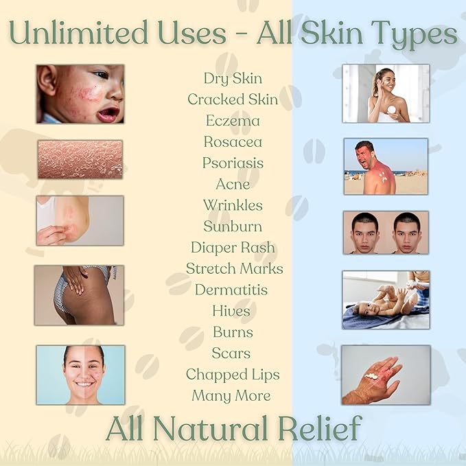 Beef Tallow Balm for Skin | NAKED TALLOW BALM | 1 Ingredient - 100% Grass Fed Grass Finished Tallow | Whole Body & Face Moisturizer | Whipped | Dry Skin, Eczema, Rosacea, (2oz)