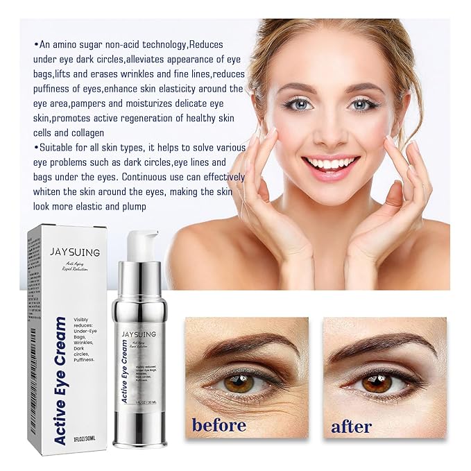 Active Eye Cream for Dark Circles & Puffiness - Anti-Aging Eye Cream with Acetyl Hexapeptide-8 & Caffeine, Reduces Eye Bags, Wrinkles & Fine Lines, Hydrating & Firming Eye Treatment