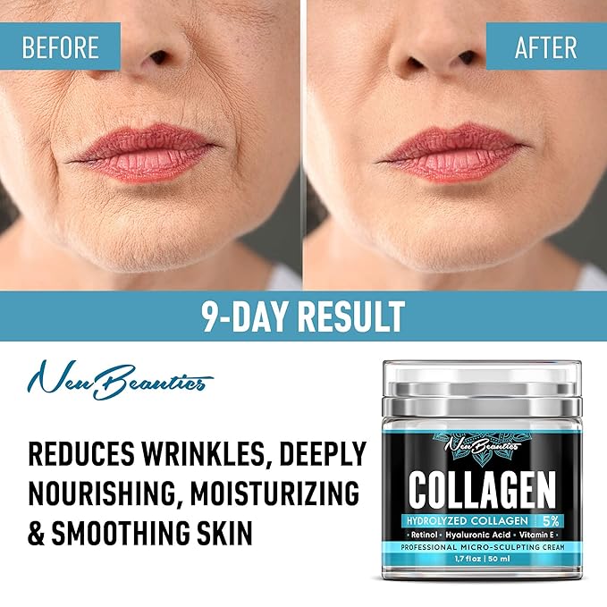 Neubeautics Collagen Cream For Face - Anti Aging Night Women Made In USA Wrinkle With Retinol Hyaluronic Acid Firming & Hydrating Effect Facial Cream, 50 ml (Neubeautics)