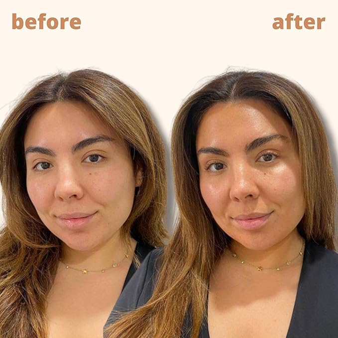 Skinny Tan Notox Face Tanning Drops - Hydrating Serum for Face with Vegan Collagen, Guarana, Aloe Vera - Reduces Appearance of Imperfections - 1 oz