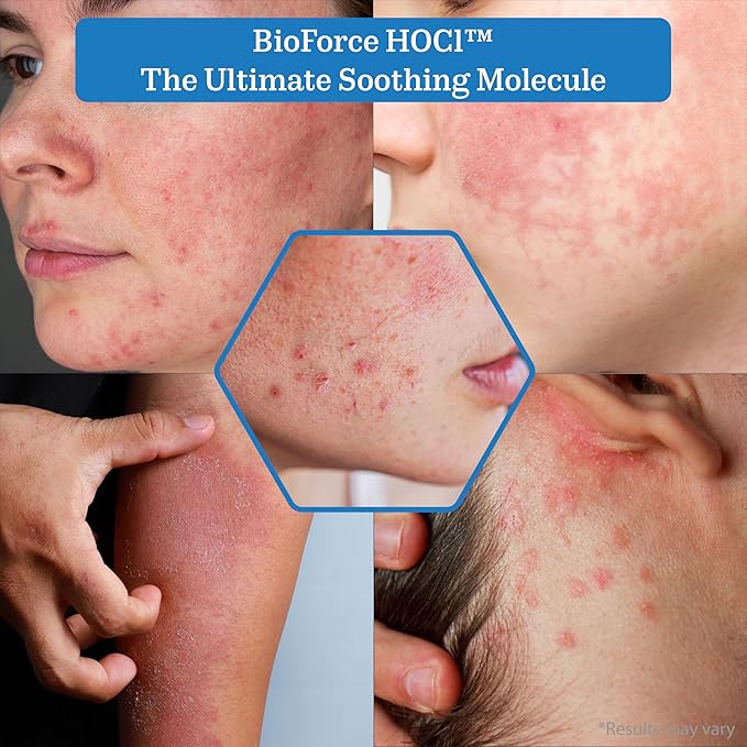 BioForce HOCl - Pure Hypochlorous Acid Spray for Face & Body - Acne-Prone Skin & Eczema, Piercing aftercare, Made in Canada, Gentle Skin Cleanser & Toner, pH Balanced, Non-comedogenic - NueVue (8.2oz)