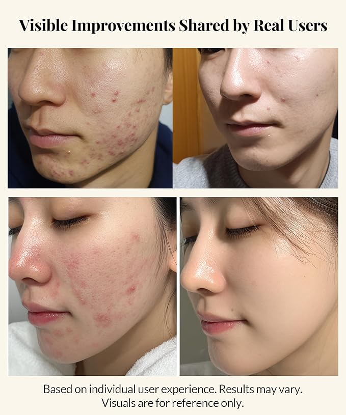 Centella Asiatica Serum Korean - Redness Corrector for Face - 38% Cica Leaf Water and Madecassoside - Ph Balanced - Barrier Support - Lightweight Calming - Rosacea Skincare Serum - Centella Ampoule