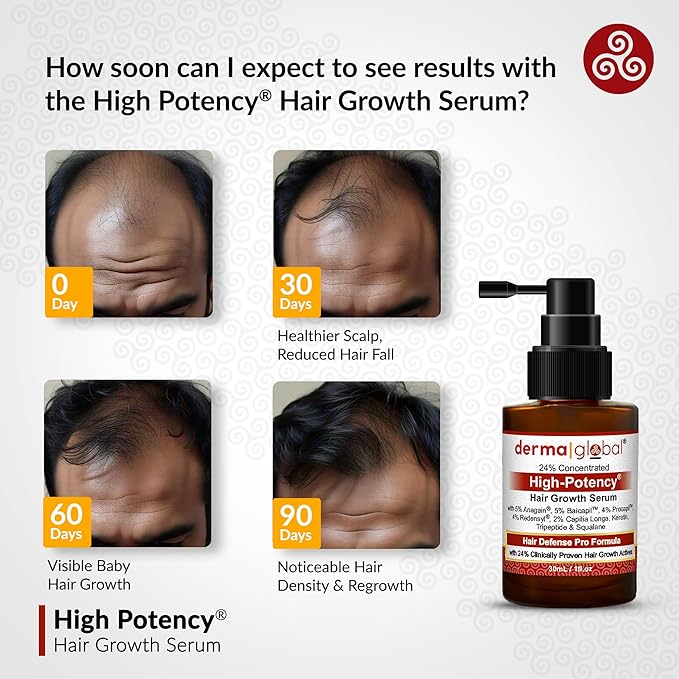 High Potency® Hair Growth Serum – Hair Defence Pro Formula | 24% Clinically Proven Actives with 5% Anagain, 5% Baicapil, 4% Procapil, Redensyl, 2% Capilia Longa, Niacinamide & Copper Peptide 30 mL