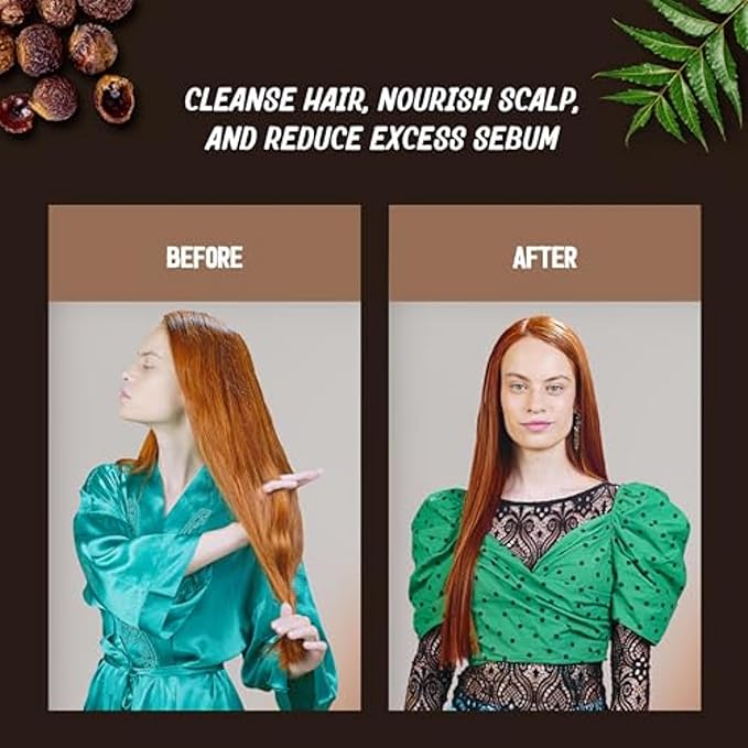Nourishing Shampoo for Women & Men - Neem & Reetha Natural Ayurvedic Hair Care - Anti Dandruff Gentle Daily Growth Formula - Healthy Scalp Strong Roots - Moisturizing & Strengthening - 10 Oz