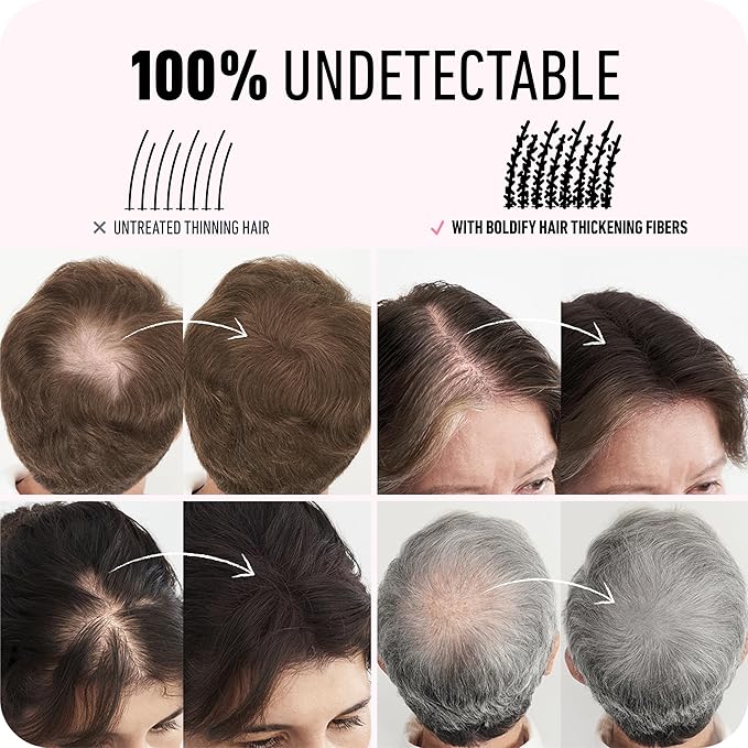 BOLDIFY Hair Fibers (12g) - Fill In Thinning and Fine Hair for an Instantly Fuller, Thicker Look - 14 Shades for Women & Men - White