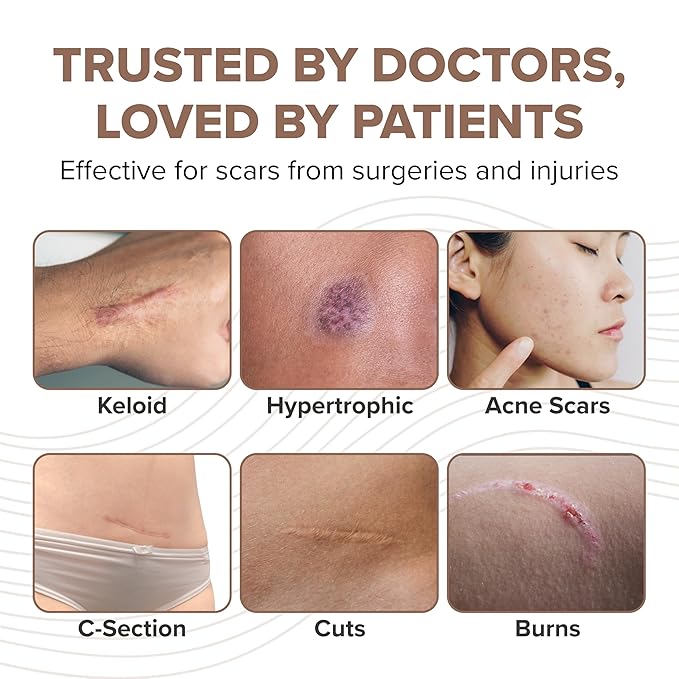 ProSil Silicone Scar Gel Stick with SPF 15 – Patented Scar Treatment in a Mess-Free, Compact Glide-On Stick - Made from Premium-Grade Silicone - Gentle on All Skin Types, Including Kids - 17g
