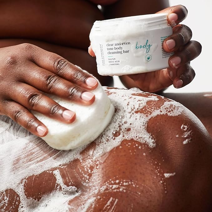 Urban Skin Rx Pro Strength Even Tone Body Cleansing Bar, Improves Appearance of Uneven Skin Tone, Includes Exfoliating Sponge, 5 Oz