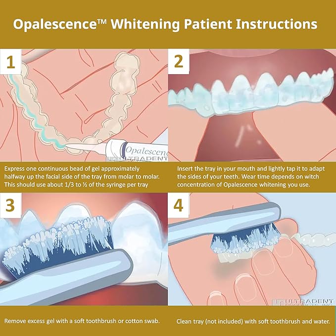 Opalescence 45% Syringes Teeth Whitening Gel - with PF - (8 Syringes) Refill Kit Carbamide Peroxide. Made by Ultradent, in Mint Flavor. Tooth Whitening 5359-4