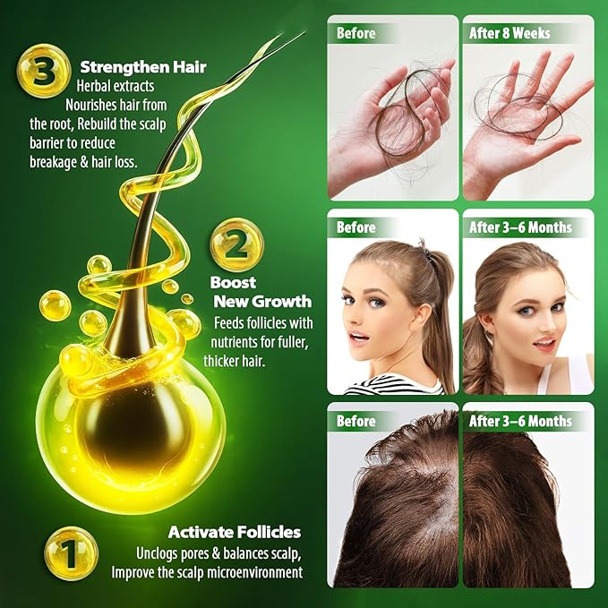 Hair Growth Serum for Thicker Hair: Lightweight Scalp Essence for Hair Growth Roller for All Hair Types Refreshing Botanical Formula (2 Pack (2 * 20ml))