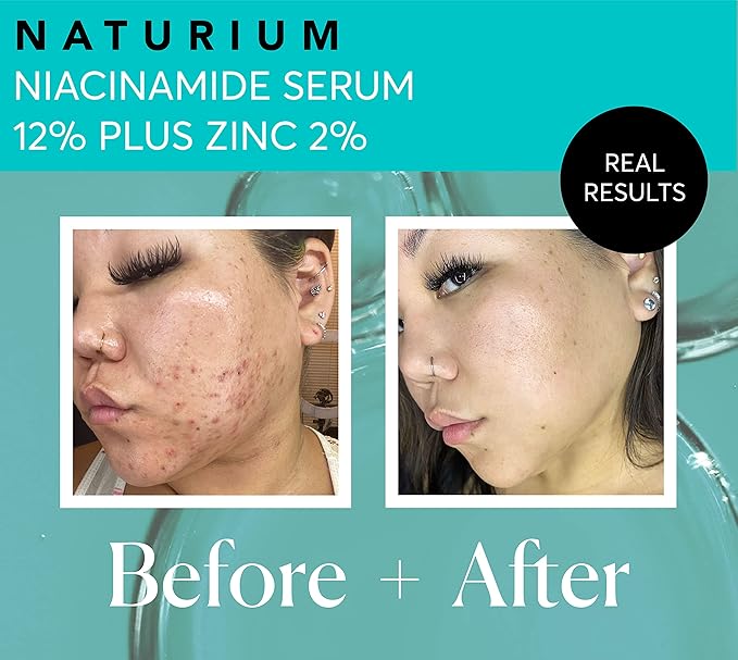Naturium Niacinamide Face Serum 12% Plus Zinc 2% Jumbo, Anti-Aging, Pore Minimizer & Dark Spot Corrector with Hyaluronic Acid & Vitamin E, Vegan & Cruelty-Free, 2 oz
