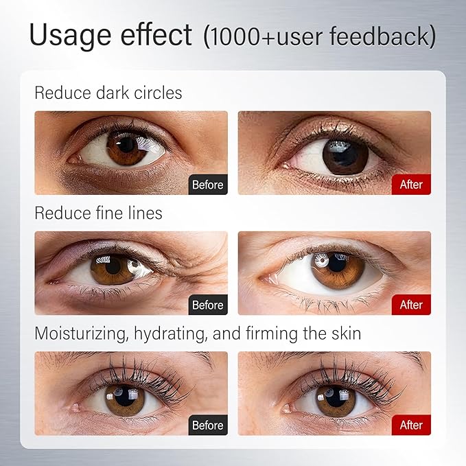 Korean 360 ° adhesive eye mask eye mask is suitable for reducing dark circles and puffiness. It is rich in hyaluronic acid, niacinamide, collagen, and anti wrinkle effects
